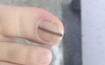 中医学从指甲查病因【全】_招生指南