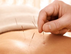 中医针灸法的特点【全】_招生问答